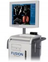 Система Fusion для операций под визуализационным контролем